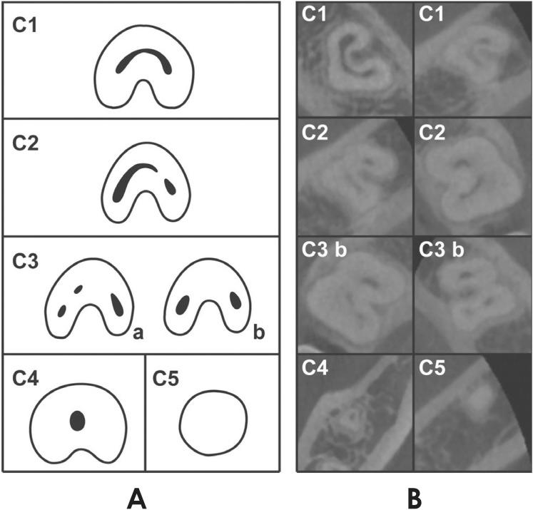 https://cdn.ncbi.nlm.nih.gov/pmc/blobs/f365/4483626/fd4cfd2ae5b2/isd-45-95-g003.jpg