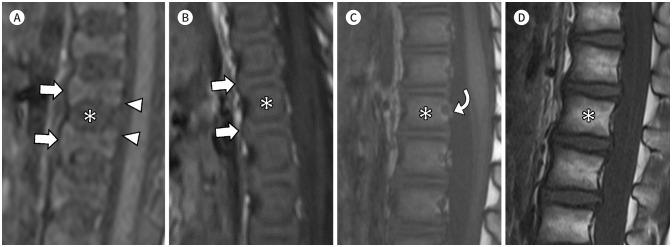 https://cdn.ncbi.nlm.nih.gov/pmc/blobs/f36b/11166593/ecc2d81df85c/jksr-85-505-g003.jpg