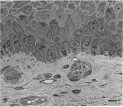 https://cdn.ncbi.nlm.nih.gov/pmc/blobs/f36e/1260416/54dd20d65bbc/janat00155-0083-e.jpg