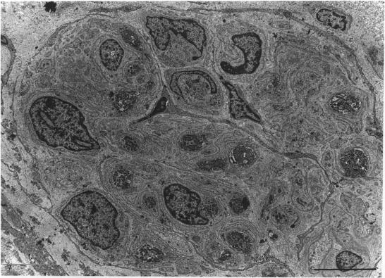 https://cdn.ncbi.nlm.nih.gov/pmc/blobs/f36e/1260416/f34194ac5759/janat00155-0085-a.jpg