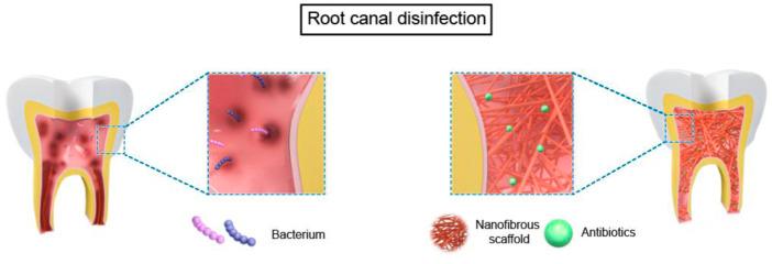 https://cdn.ncbi.nlm.nih.gov/pmc/blobs/f36f/9790898/efcb52bc833a/fbioe-10-1078453-g002.jpg