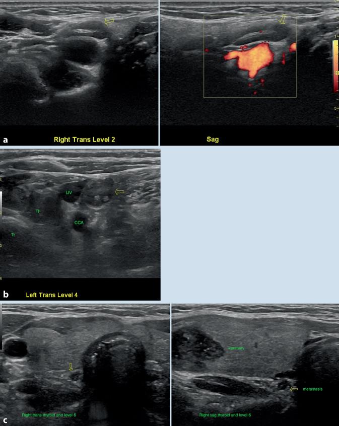 https://cdn.ncbi.nlm.nih.gov/pmc/blobs/f370/8974803/78d773d89fa5/106_2022_1162_Fig6_HTML.jpg