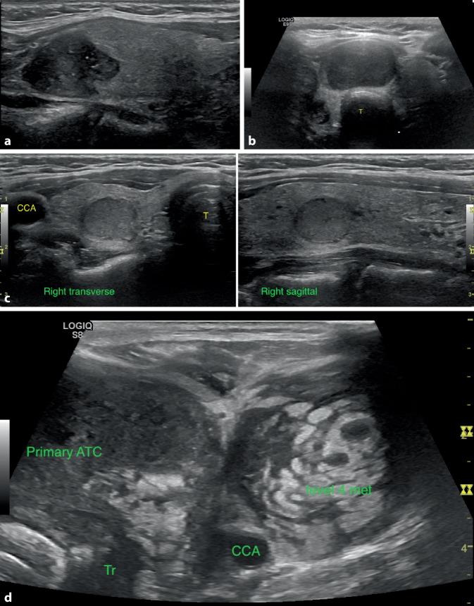 https://cdn.ncbi.nlm.nih.gov/pmc/blobs/f370/8974803/f54c7883c719/106_2022_1162_Fig3_HTML.jpg
