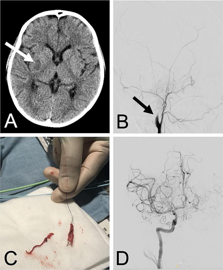 https://cdn.ncbi.nlm.nih.gov/pmc/blobs/f372/8894621/6461f357516d/10.1177_21501351221075840-fig1.jpg