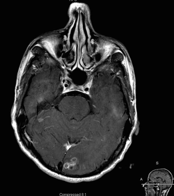 https://cdn.ncbi.nlm.nih.gov/pmc/blobs/f375/4672616/b41a8be90386/gr1.jpg