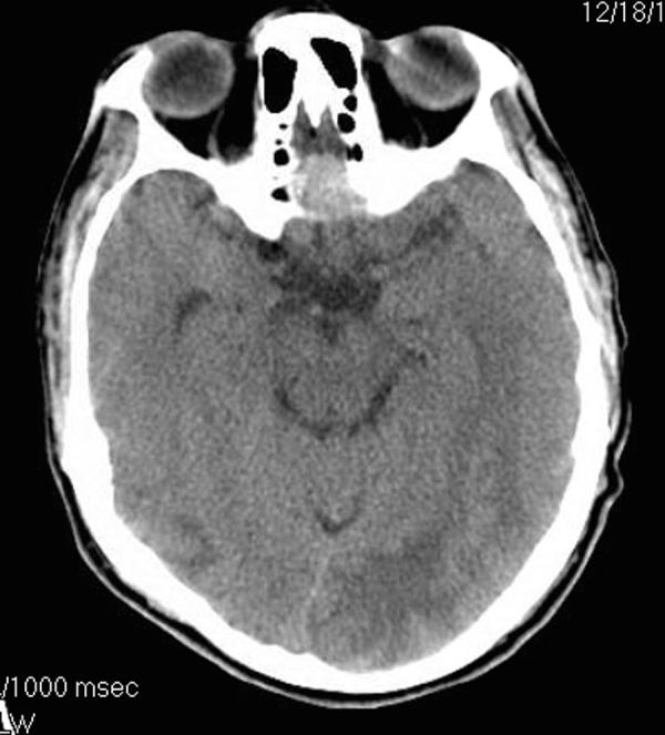 https://cdn.ncbi.nlm.nih.gov/pmc/blobs/f375/4672616/bf8aefa89c78/gr2.jpg