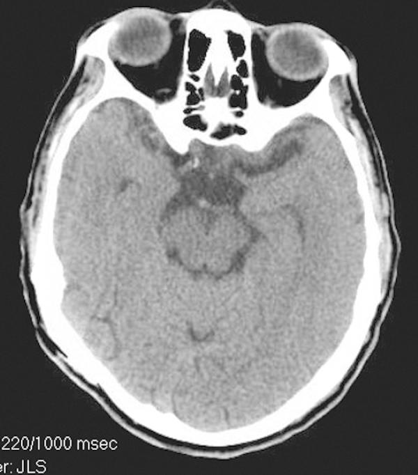 https://cdn.ncbi.nlm.nih.gov/pmc/blobs/f375/4672616/d6b7cbd941cb/gr3.jpg