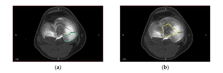 https://cdn.ncbi.nlm.nih.gov/pmc/blobs/f37d/7999307/6bff8c2de96b/jpm-11-00190-g002.jpg