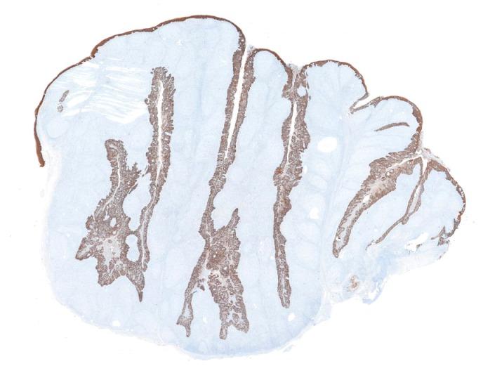 https://cdn.ncbi.nlm.nih.gov/pmc/blobs/f37f/4273168/399f177c0f43/CTO-13-07-g-001.jpg