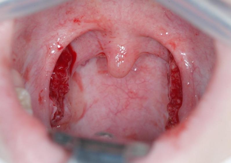 https://cdn.ncbi.nlm.nih.gov/pmc/blobs/f37f/4273168/92c3ba65ce39/CTO-13-07-g-006.jpg