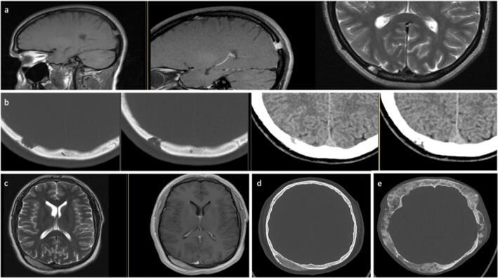 https://cdn.ncbi.nlm.nih.gov/pmc/blobs/f387/8594273/5f5167406ba2/10143_2021_1521_Fig4_HTML.jpg