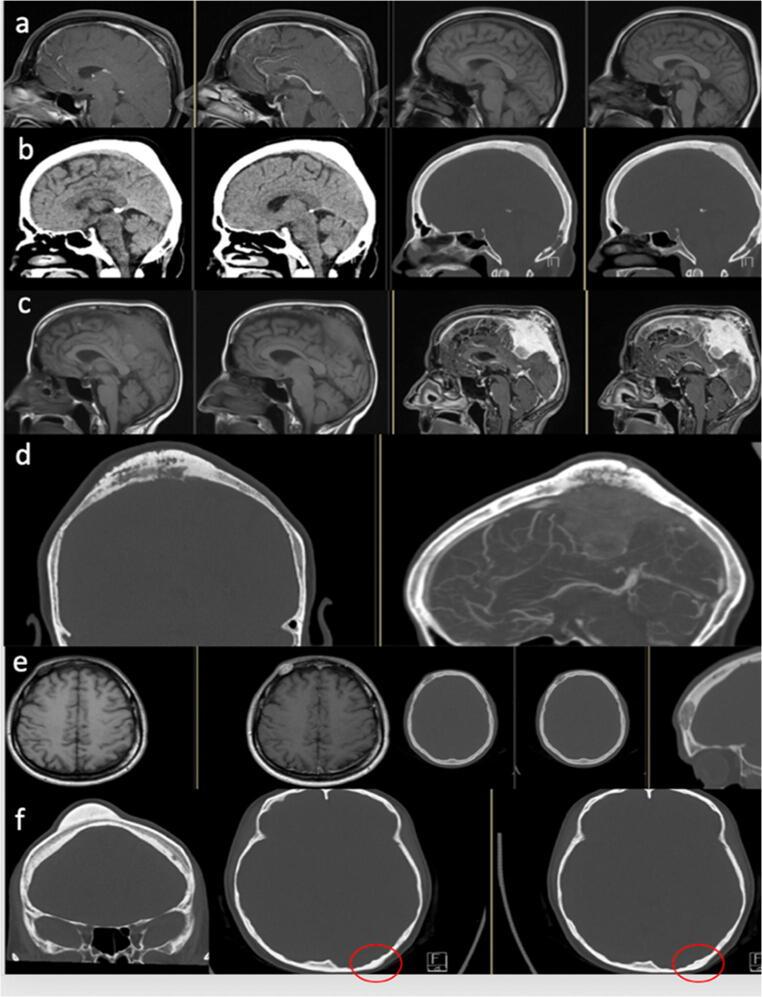https://cdn.ncbi.nlm.nih.gov/pmc/blobs/f387/8594273/e1c280c30c03/10143_2021_1521_Fig2_HTML.jpg