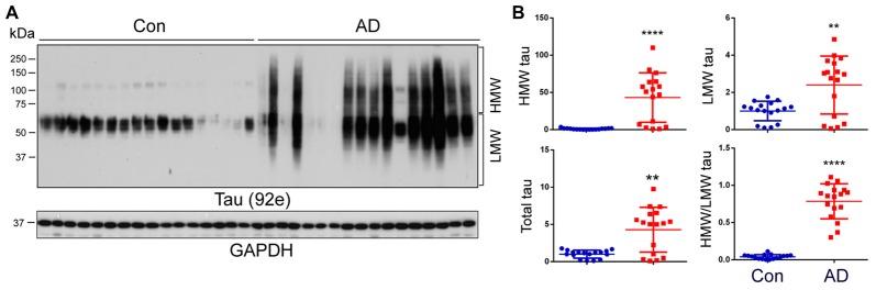 https://cdn.ncbi.nlm.nih.gov/pmc/blobs/f38b/5810298/aa7299f93a96/fnagi-10-00027-g0001.jpg