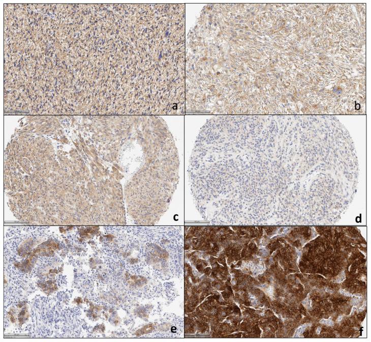 https://cdn.ncbi.nlm.nih.gov/pmc/blobs/f38d/11119314/f330b741ba62/cancers-16-01874-g003.jpg