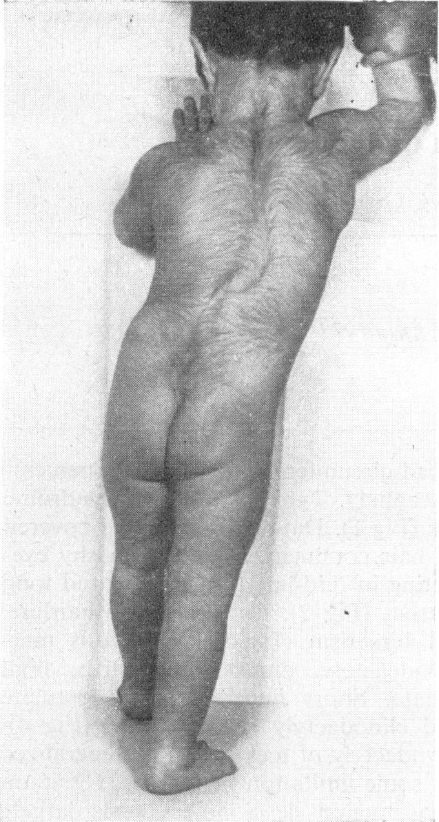 https://cdn.ncbi.nlm.nih.gov/pmc/blobs/f38d/1645328/6f5f74b9ca63/procrsmed00327-0038-a.jpg