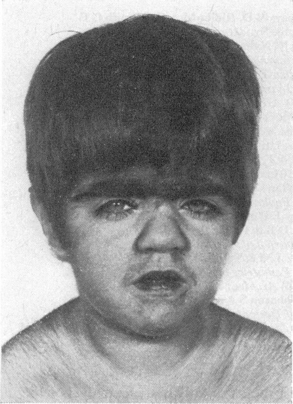 https://cdn.ncbi.nlm.nih.gov/pmc/blobs/f38d/1645328/a0121094c97f/procrsmed00327-0037-a.jpg