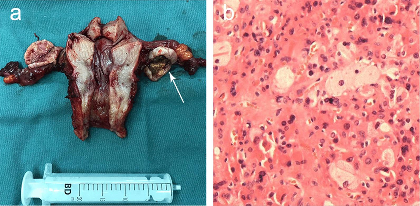 https://cdn.ncbi.nlm.nih.gov/pmc/blobs/f38e/8513290/893889394026/13023_2021_2057_Fig6_HTML.jpg