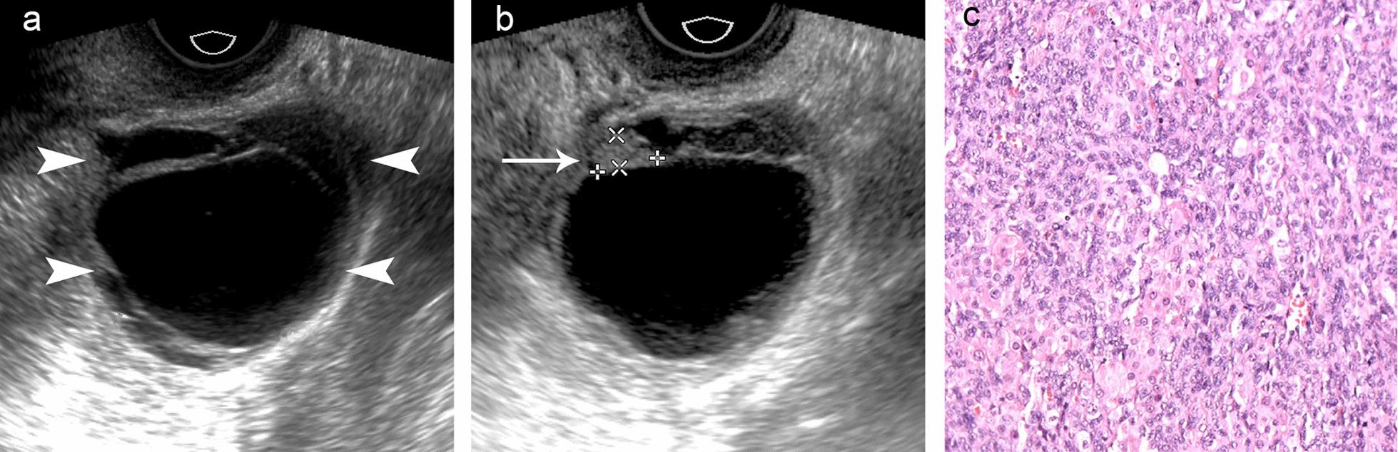 https://cdn.ncbi.nlm.nih.gov/pmc/blobs/f38e/8513290/8ecc58fe3a13/13023_2021_2057_Fig4_HTML.jpg