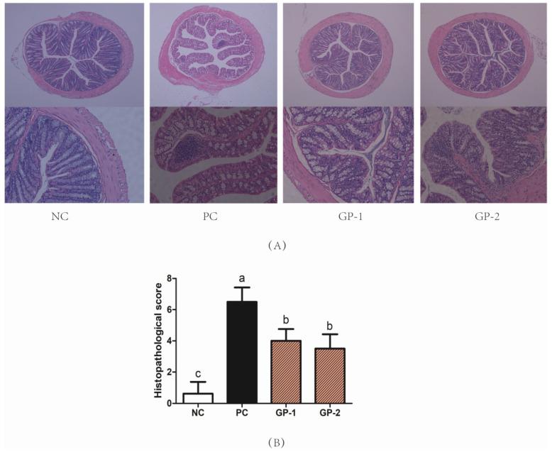 https://cdn.ncbi.nlm.nih.gov/pmc/blobs/f38e/9003490/acab3271a4f9/nutrients-14-01479-g004.jpg