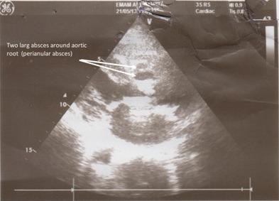 https://cdn.ncbi.nlm.nih.gov/pmc/blobs/f393/4322321/3e7ca3eb55b1/MJIRI-28-146-g003.jpg