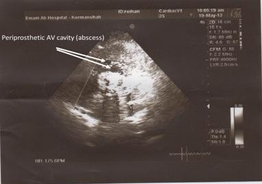 https://cdn.ncbi.nlm.nih.gov/pmc/blobs/f393/4322321/95fe572996a7/MJIRI-28-146-g001.jpg