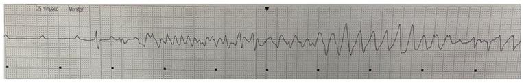 https://cdn.ncbi.nlm.nih.gov/pmc/blobs/f393/9125101/d6a99dc34c60/10.1177_23247096221098333-fig2.jpg