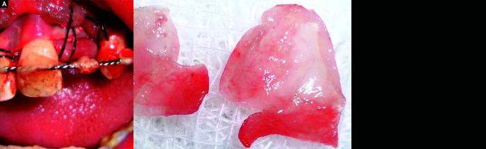 https://cdn.ncbi.nlm.nih.gov/pmc/blobs/f399/8783223/aef2ac5a5d25/ijcpd-14-820-g005.jpg