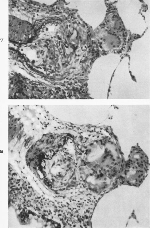 https://cdn.ncbi.nlm.nih.gov/pmc/blobs/f39d/1942825/07e077e40168/amjpathol00600-0023-a.jpg