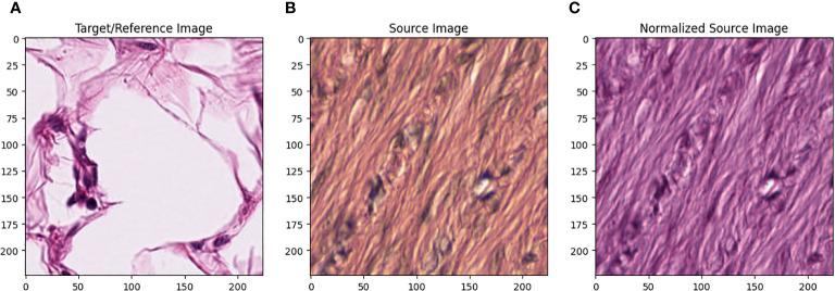 https://cdn.ncbi.nlm.nih.gov/pmc/blobs/f39e/10827850/51990dfcf282/fonc-13-1325271-g001.jpg