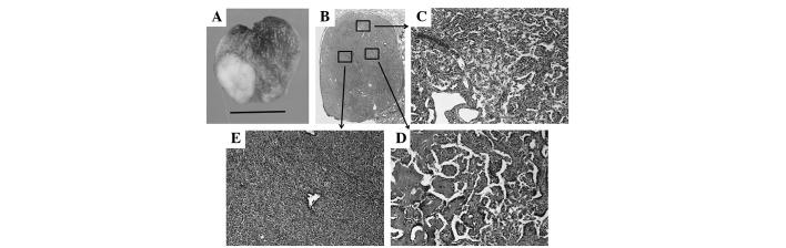 https://cdn.ncbi.nlm.nih.gov/pmc/blobs/f3a1/3961406/6c1107ccc1e3/OL-07-04-0997-g01.jpg