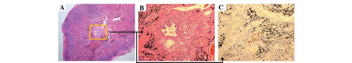 https://cdn.ncbi.nlm.nih.gov/pmc/blobs/f3a1/3961406/e200fc9b8aa6/OL-07-04-0997-g03.jpg