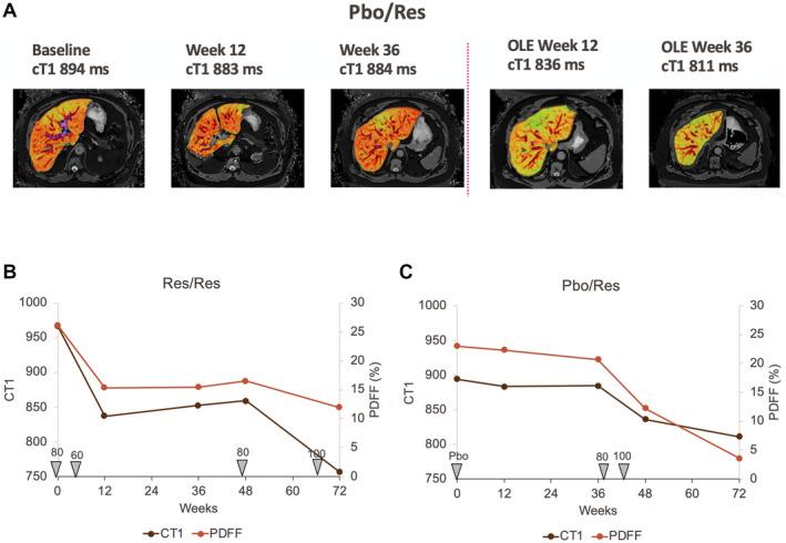https://cdn.ncbi.nlm.nih.gov/pmc/blobs/f3a2/8034581/c14d2985d51c/HEP4-5-573-g002.jpg