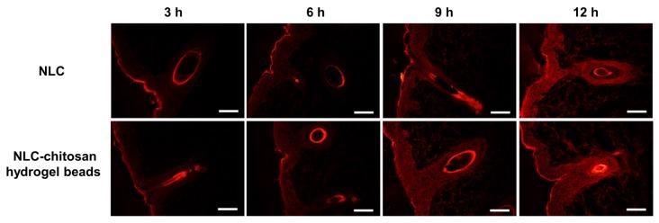 https://cdn.ncbi.nlm.nih.gov/pmc/blobs/f3a3/10970608/206c2d7a8a1e/gels-10-00160-g009.jpg