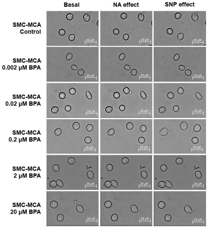 https://cdn.ncbi.nlm.nih.gov/pmc/blobs/f3a7/12027836/15d8c4d20b5b/ijms-26-03896-g004.jpg