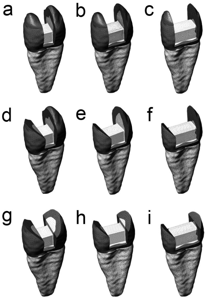 https://cdn.ncbi.nlm.nih.gov/pmc/blobs/f3a8/3541583/b3cc75ea4859/CroatMedJ_53_0568-F1.jpg