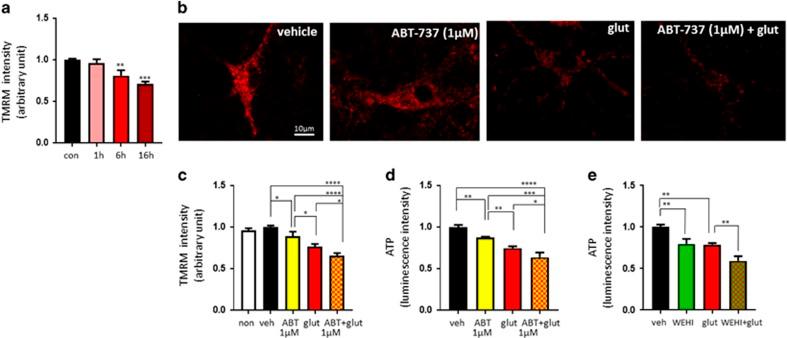 https://cdn.ncbi.nlm.nih.gov/pmc/blobs/f3ac/5635221/80bb85bb811e/cdd2017123f2.jpg
