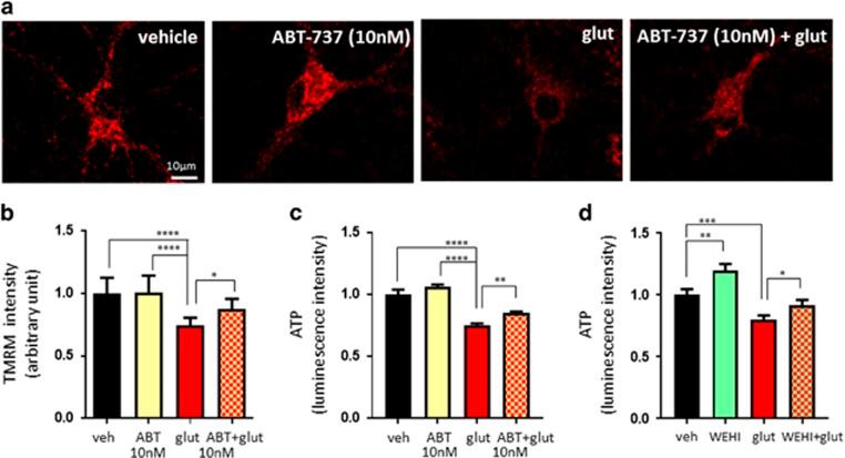 https://cdn.ncbi.nlm.nih.gov/pmc/blobs/f3ac/5635221/afeb91949cd1/cdd2017123f4.jpg