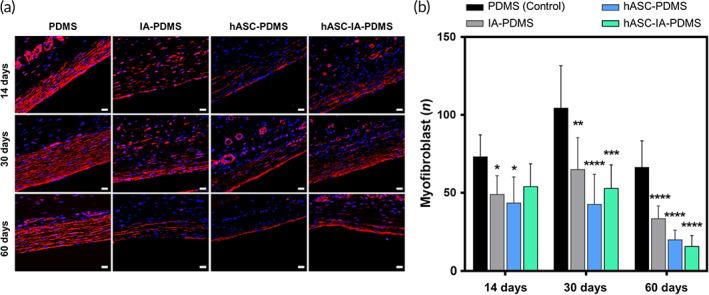 https://cdn.ncbi.nlm.nih.gov/pmc/blobs/f3ac/8780897/54e13877f5f6/BTM2-7-e10260-g006.jpg