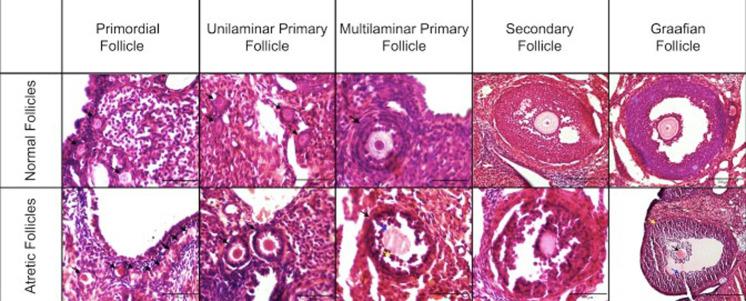 https://cdn.ncbi.nlm.nih.gov/pmc/blobs/f3b1/11254495/7e46710a86c8/expanim-73-319-g003.jpg