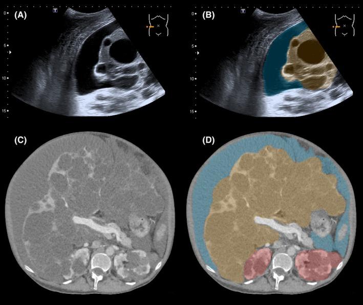 https://cdn.ncbi.nlm.nih.gov/pmc/blobs/f3b8/6899472/e498416ca304/LIV-39-2024-g003.jpg