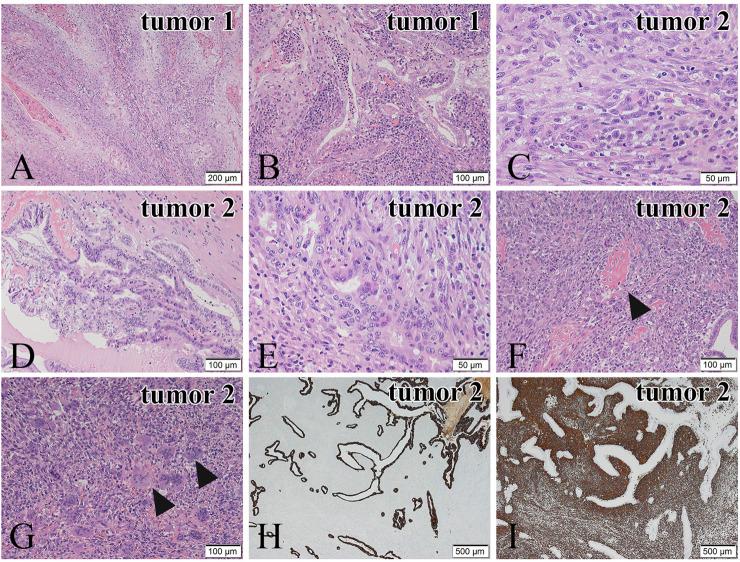 https://cdn.ncbi.nlm.nih.gov/pmc/blobs/f3bb/8983827/0832c2f067f5/pore-28-1610134-g002.jpg
