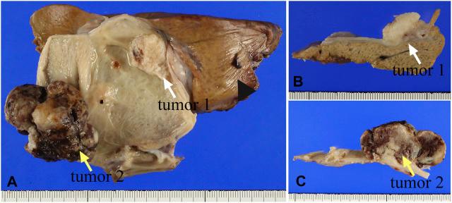 https://cdn.ncbi.nlm.nih.gov/pmc/blobs/f3bb/8983827/555c1d0f7cf4/pore-28-1610134-g001.jpg