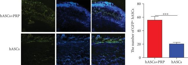 https://cdn.ncbi.nlm.nih.gov/pmc/blobs/f3bd/6874957/3c3d10540d16/SCI2019-3091619.008.jpg