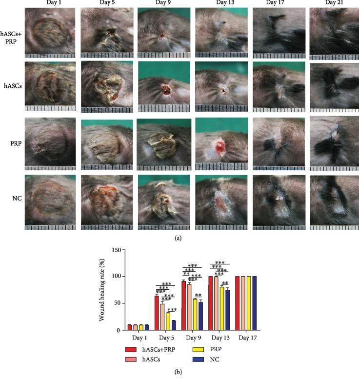 https://cdn.ncbi.nlm.nih.gov/pmc/blobs/f3bd/6874957/d5092792468f/SCI2019-3091619.003.jpg