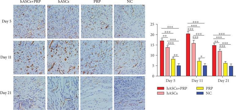 https://cdn.ncbi.nlm.nih.gov/pmc/blobs/f3bd/6874957/dabce7140bed/SCI2019-3091619.006.jpg