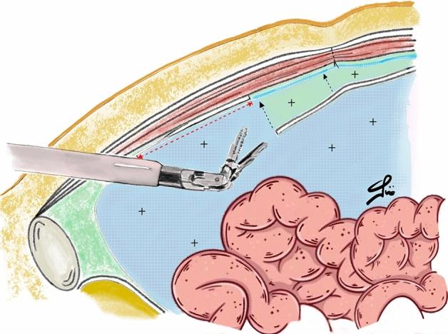 https://cdn.ncbi.nlm.nih.gov/pmc/blobs/f3be/10799892/335ce14c95fb/41598_2024_52165_Fig3_HTML.jpg