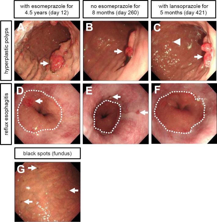 https://cdn.ncbi.nlm.nih.gov/pmc/blobs/f3c4/10982011/55cdffe1b18d/1349-7235-63-0649-g003.jpg