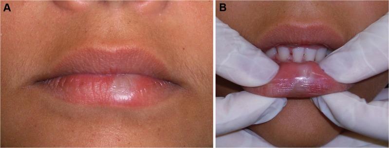 https://cdn.ncbi.nlm.nih.gov/pmc/blobs/f3c8/5549513/a4883010cdbd/medoral-22-e410-g001.jpg