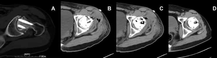 https://cdn.ncbi.nlm.nih.gov/pmc/blobs/f3db/6551358/5110f5de3c34/gr3.jpg