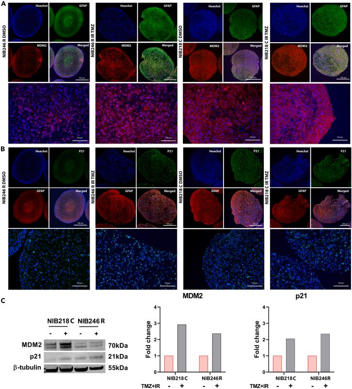 https://cdn.ncbi.nlm.nih.gov/pmc/blobs/f3dd/11381849/4521683e591f/gr5.jpg
